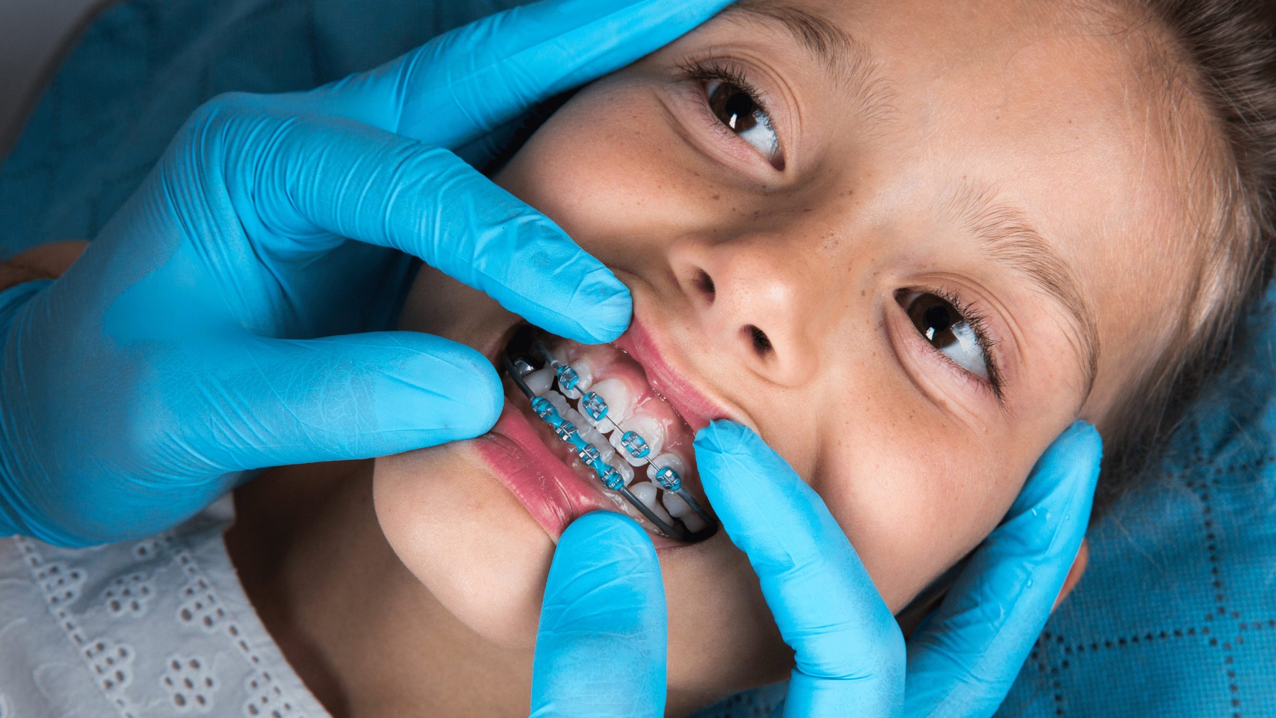 aparat ortodontyczny u dzieci warszawa